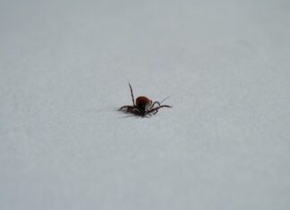 Czemu zbiera się limfa pod oczami?